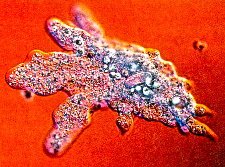 An amoeba.